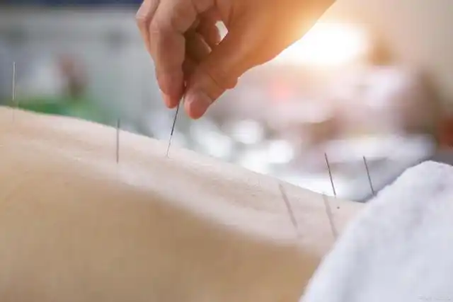 慢性腰痛发作起来夜不能寐,怎么办?不妨试着选择针灸缓解