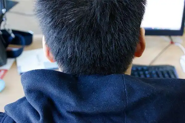 是怎么一回事后脑勺疼是怎么回事