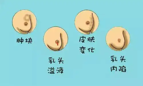 被乳腺癌毁掉的中国女性!坐着,躺着教你正确进行乳房自检!