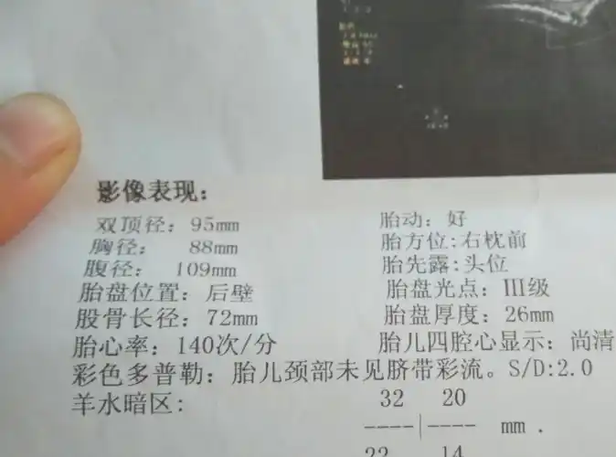 孕妈做产检时,b超单上若有这3种表现,准爸爸或许迎来"小情人"_长度