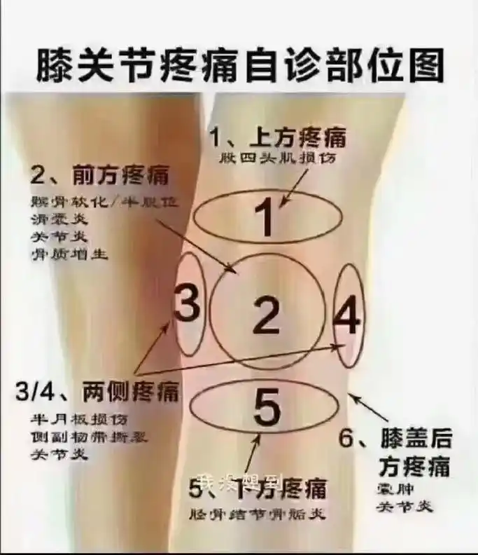 91 有一种冷叫骨缝都透风[快哭了] 有一种响叫膝盖咔咔响[ - 抖音