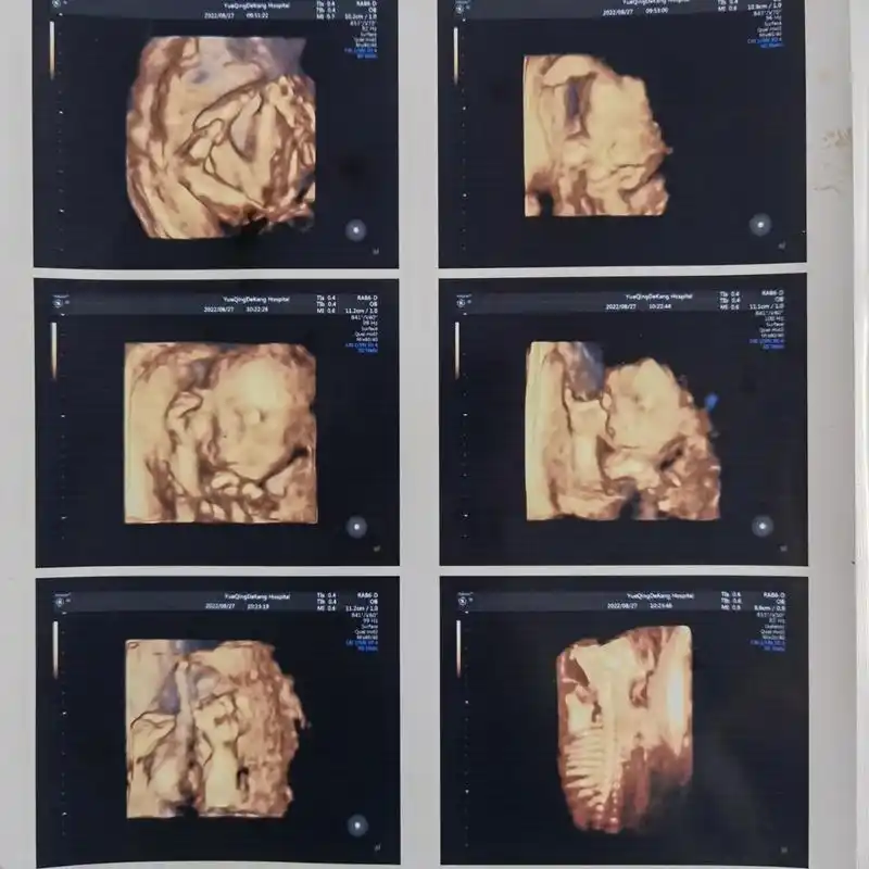 久违的四维彩超图片以及马上孕6个月的肚子~ 22 5做四维的日子 一直