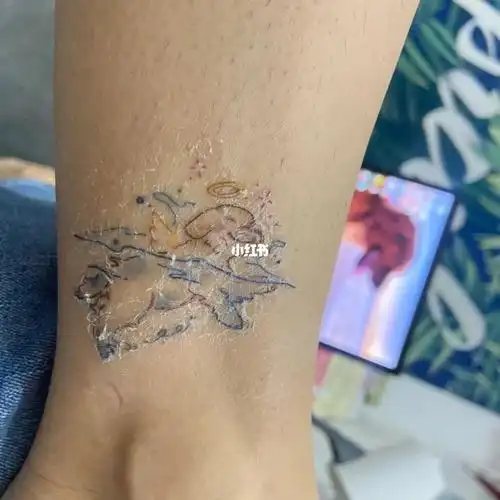 纹身的第十七天终于开始大面积掉痂了