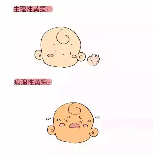 629孕妈课堂新手妈妈不得不了解的新生儿黄疸种类辨识与消退方法