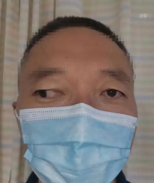 暑假到了, 不少小朋友斗鸡眼,眼位不正,来做手术.