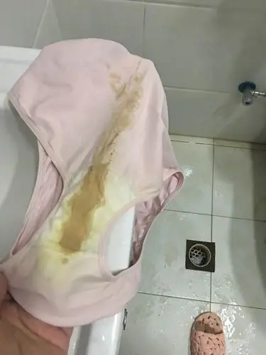 尿一样黄色分泌物很多,怀孕35周.