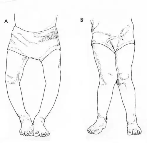 小孩大腿简笔画