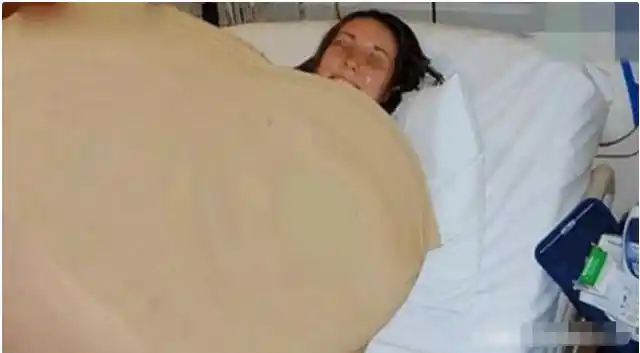 孕妇当年一次生下17胞胎,承受巨大生活开销,她们现状如何?