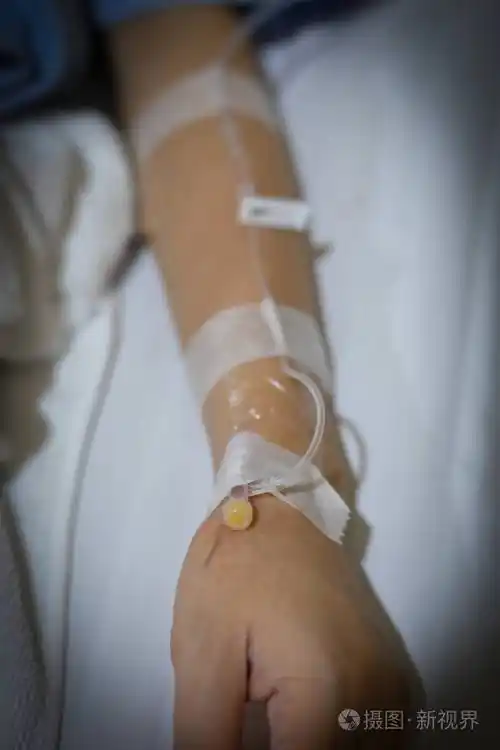 卧床病人静脉输液静脉注射照片-正版商用图片29fg3t-摄图新视界