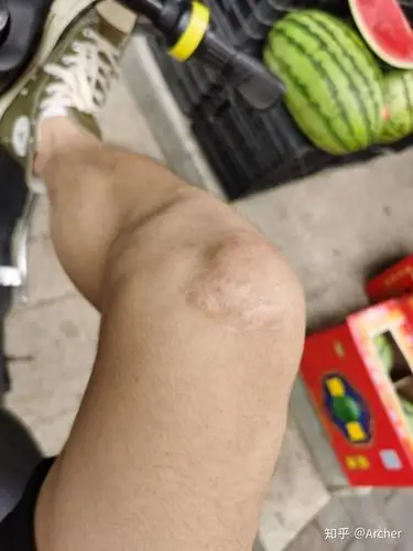 参军我这个疤痕能不能通过体检