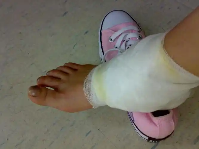 05.11 好黑吖～    今天早上带操的时候,光荣受伤了.