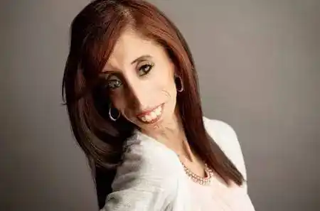 世上最丑的女人又如何,至少她有勇气面对自己