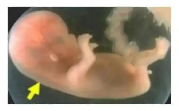 需要空腹憋尿吗?和普通b超有什么关系?怎么做能顺利通过?