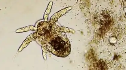 你知道吗?有一种虫子叫阴虱的#虱子 #虱子卵 #阴虱