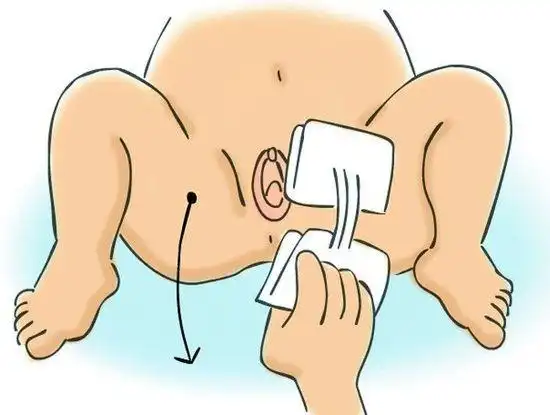 严重时还会导致尿道炎成都妈妈网 月子考察团 03 男女宝宝私密处