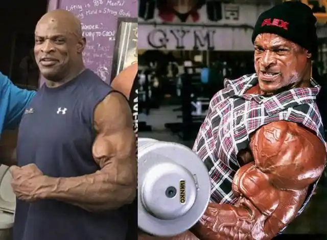 罗尼·库尔曼再次手术消瘦很多,网友:瘦死的骆驼比马大!