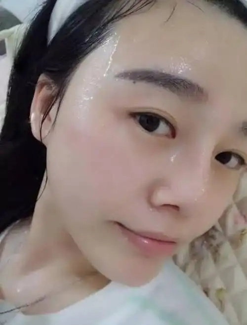 药店一种乳白色的液体,每天用三滴,去皱比打玻尿酸要强50倍