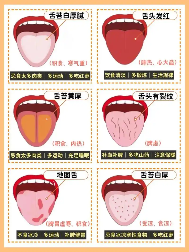 看看宝宝的舌头,如果是这种症状就要留意啦 宝宝的舌