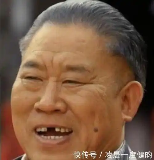 长得有黑又丑的一个男明星叫什么来着忘了