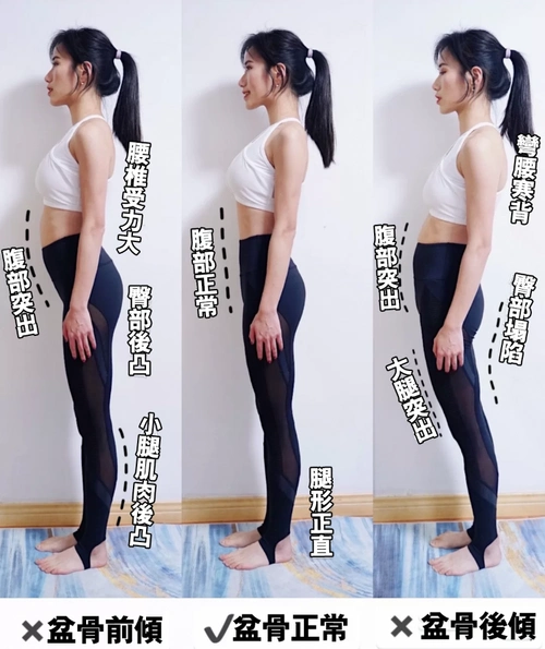 5个盆骨前倾矫正动作 改善腰痛,肚腩及大腿突出体态问题 | 运动瘦身 |