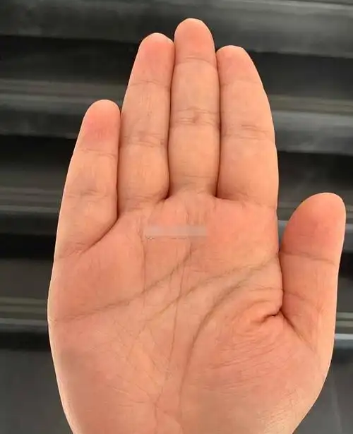 水形手,手软而手纹细,手掌和手指都丰圆细腻.