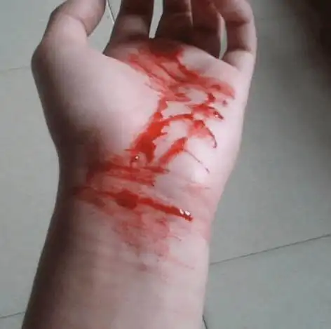 【那个叫落落的孩子受伤了,可令人意外的是……】