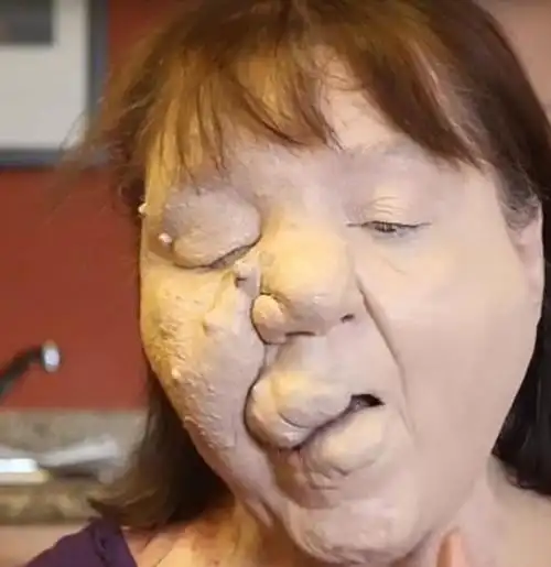 丑女人集合了,认为嫁得出去的,请打我电话