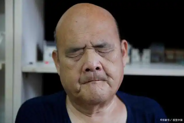 面瘫的前兆有哪些?面瘫该如何治疗?