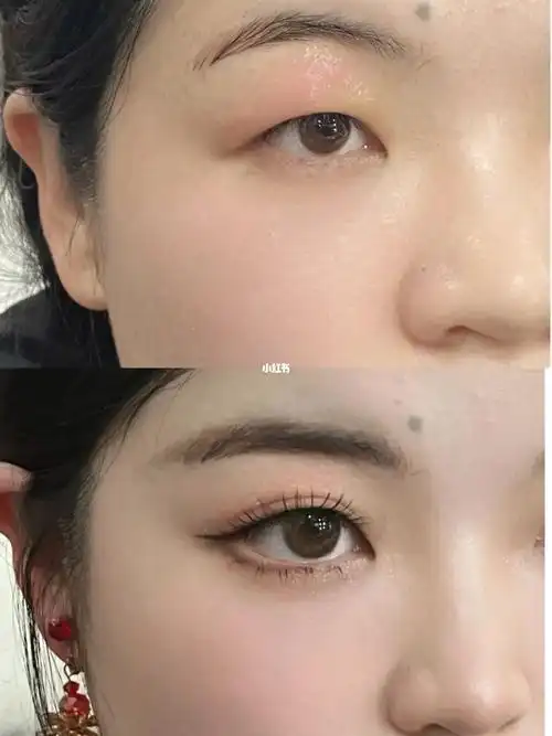 单眼皮vs双眼皮