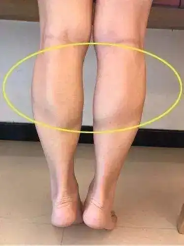 尤其是低碳水化合物饮食的情况下,腿部肌肉中的肌糖原浓度会再次下降