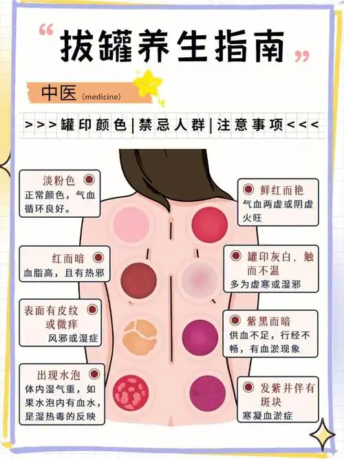 拔罐养生指南注意事项72禁忌人群