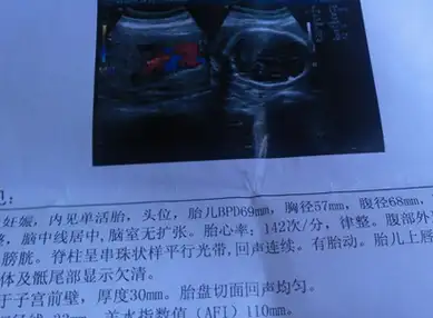 孕妈若有这3个发现,或许是宝宝在告诉你,你想知道的_性别_数据_变化