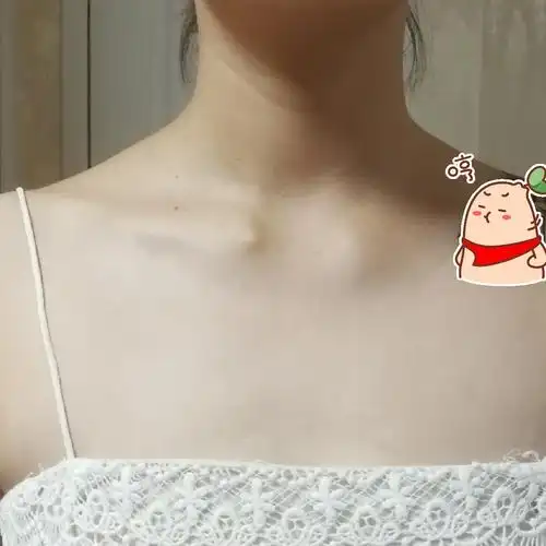 我的锁骨怎么了