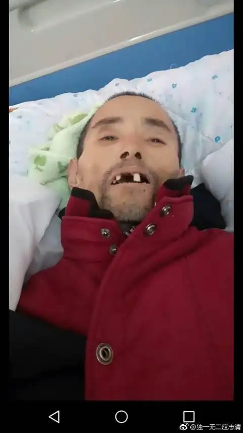 眼睛睁着像在哭,瞳孔没散,请问是不是弄错了呀,没死的人被人诊断死亡