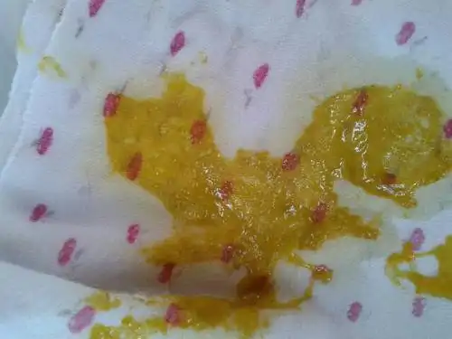 (有图慎入)宝妈们帮忙看看,宝宝的大便什么情况?是不是积食了?