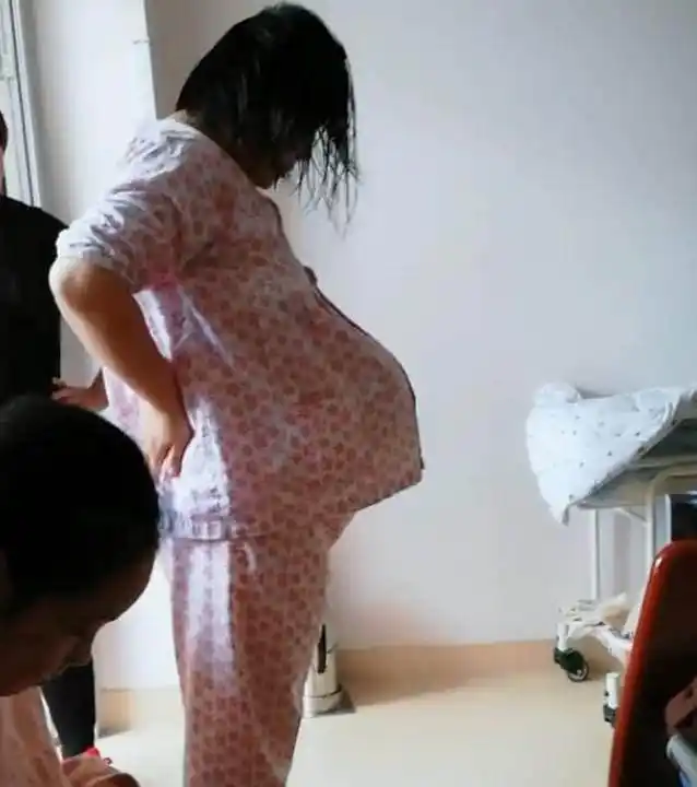 "悬浮肚"十产九剖,若想顺产也需过这2关,看后觉得心疼_肚子