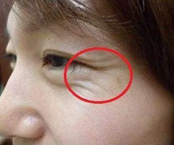 鱼尾纹多的女人真的克夫吗有一种鱼尾纹男人有财女人有福