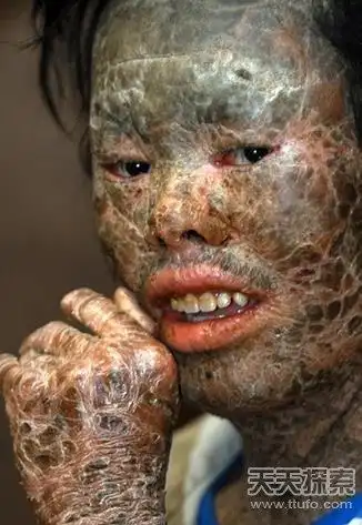 得怪病的人 难治的怪病