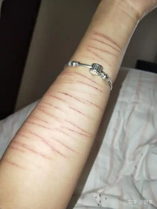 自残属于什么心理? - 知乎