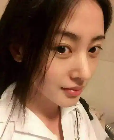 张天爱素颜出镜《中国医生》,脸上的压痕很真实,网友:素颜更美