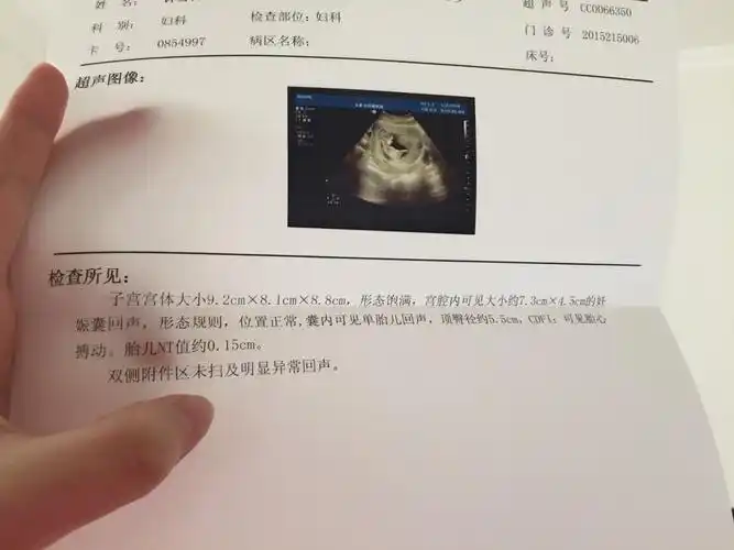 学会了看孕囊看男宝女宝,提供数据就行.