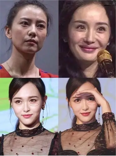 即使女明星们她们_圈子-新氧美容整形