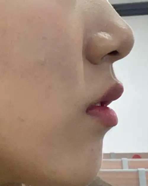 只有说话的时候嘴看起来很凸