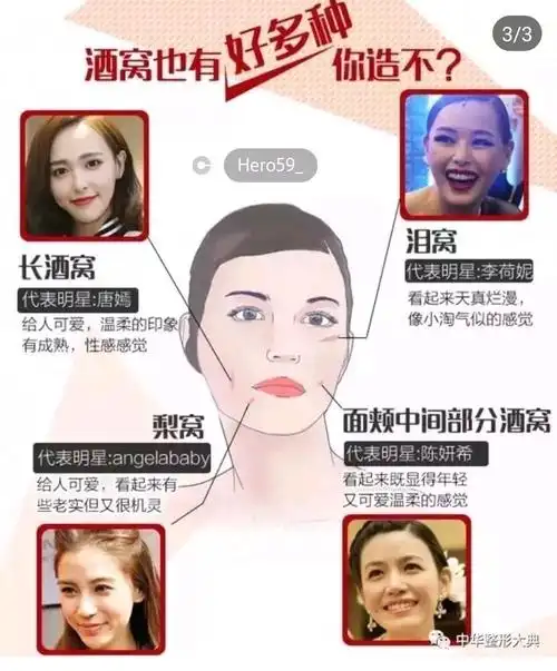 酒窝以下几种类型:  长酒窝:如唐嫣,可爱,温柔的印象,成熟,性感的感觉