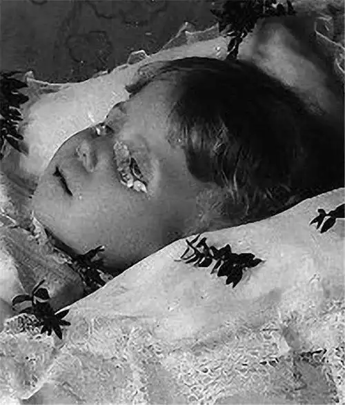 一个小女孩(左)在爱荷华州去世后不久拍摄的,和1856年去世的小男孩,看