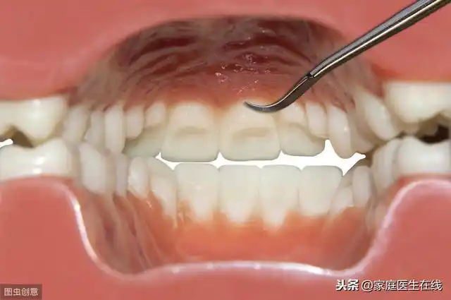 有4个特点的人和口腔癌的距离比一般人要近