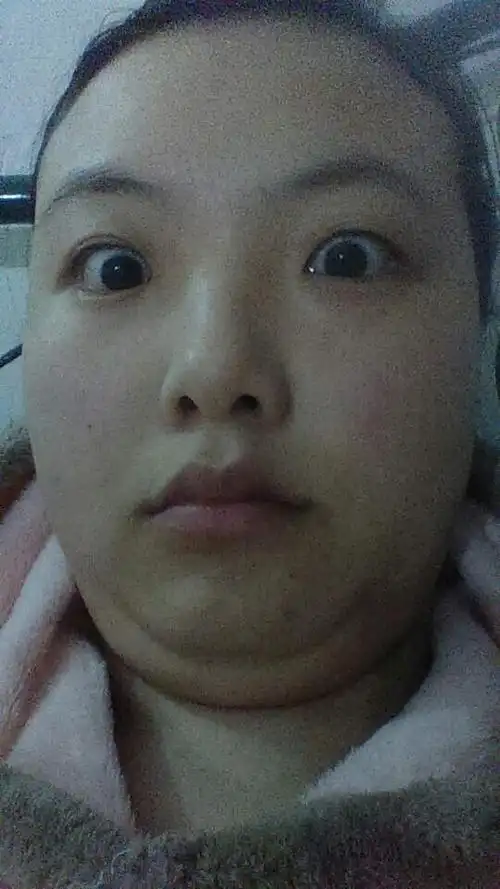 纯素颜无ps神角度惊恐大饼双下巴…这么丑还不减肥更待何时,16号不