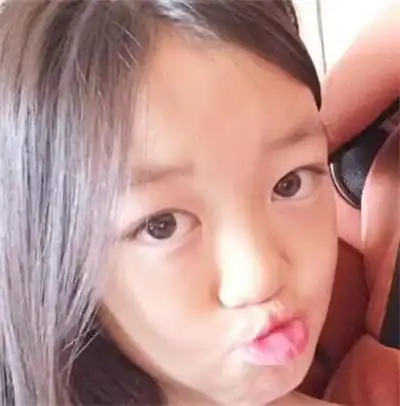 【图】李亚鹏女儿兔唇原因引猜测 手术过后修复效果良好