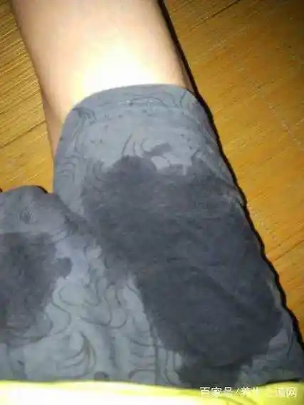 不手淫就会遗精怎么办