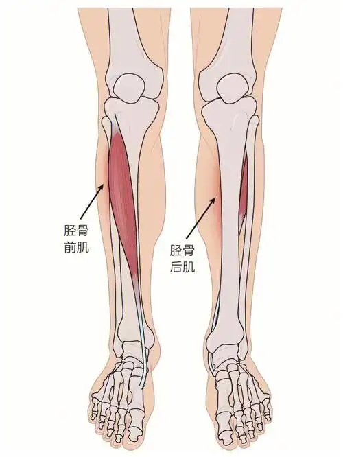 运动康复 #神经肌肉损伤  #胫痛症· 体征和症状· 典型病史· 相关